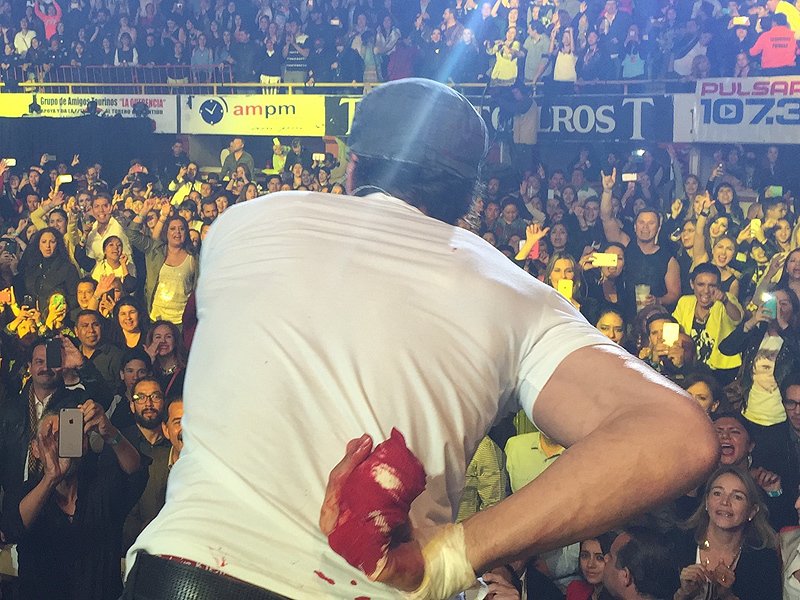 Enrique Iglesias na koncertu omylem strčil ruku do vrtule dronu a ošklivě se poranil.