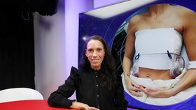 Hostem Epicentra byla Denisa Sládková, zakladatelka instagramového profilu Breast Implant Illness Czech (9.4.2024)