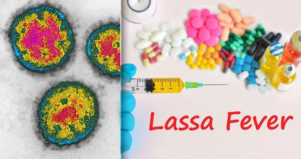 Epidemie Lassa v Nigérii