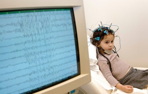 Lékaři se snaží vyzrát na epilepsii. V boji jim pomáhají i mobilní aplikace