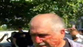 Zraněný muž v bitce, na niž se díval turecký prezident