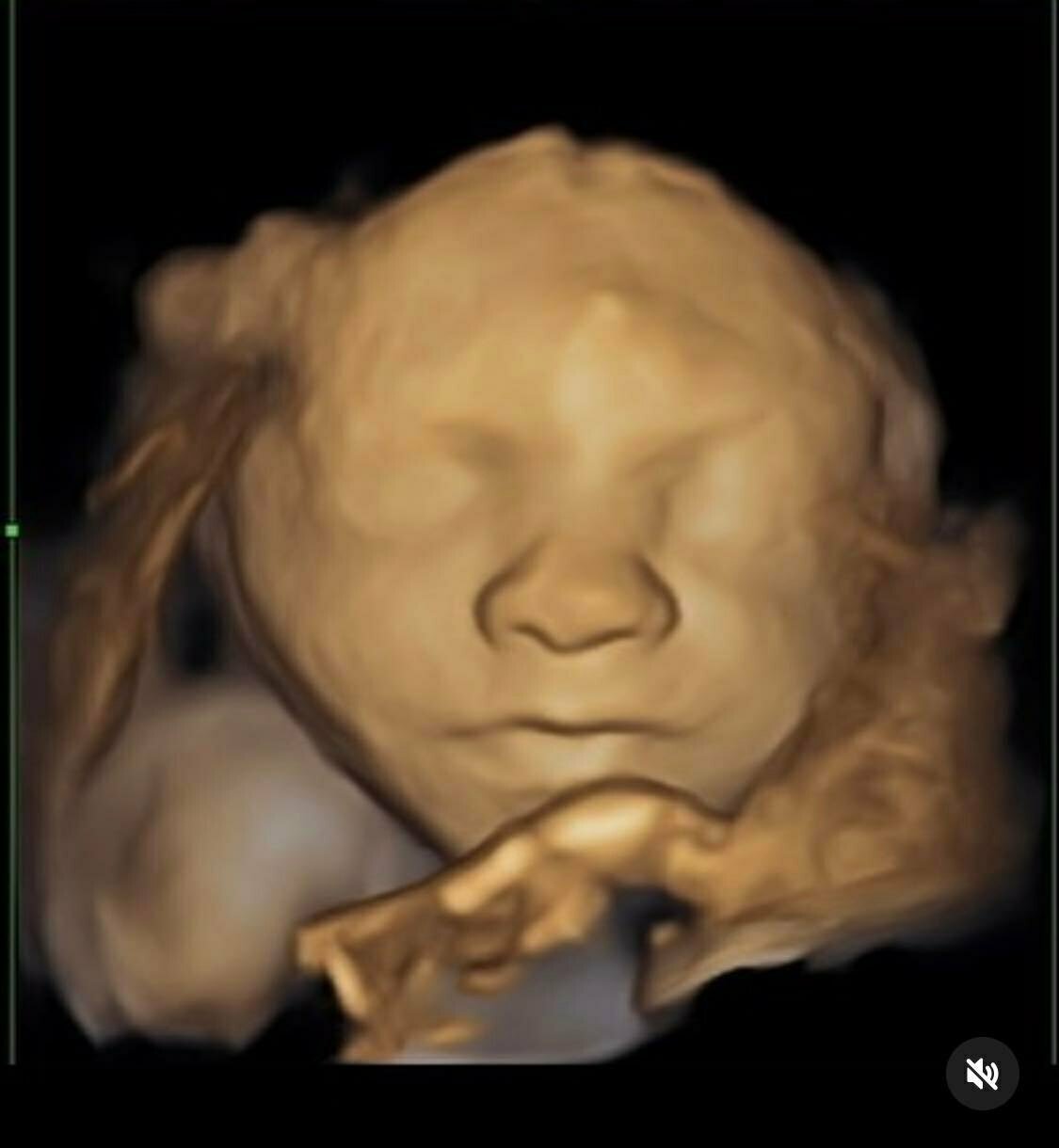 Ester Janečková ukázala 3D ultrazvuk miminka, které bude mít brzy její syn.
