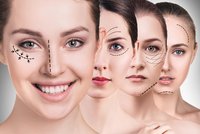 Mýty a pravdy ze světa estetické medicíny: Po botoxu jako vosková panna?