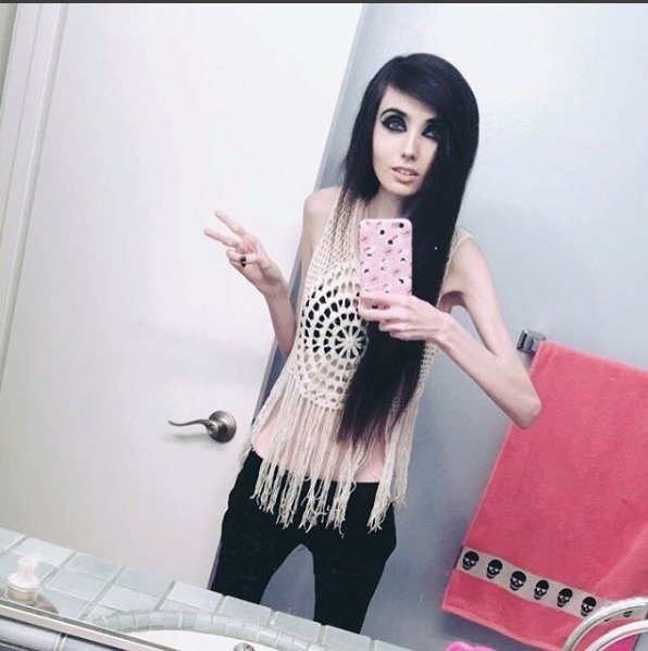 Nejsledovanější anorektička Eugenia Cooney.