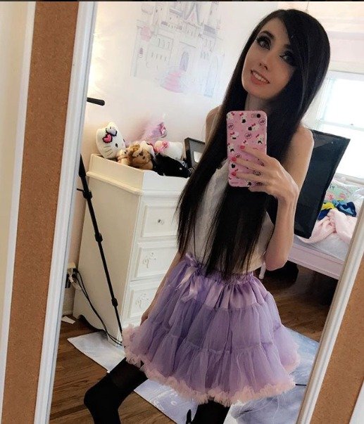 Nejsledovanější anorektička Eugenia Cooney.