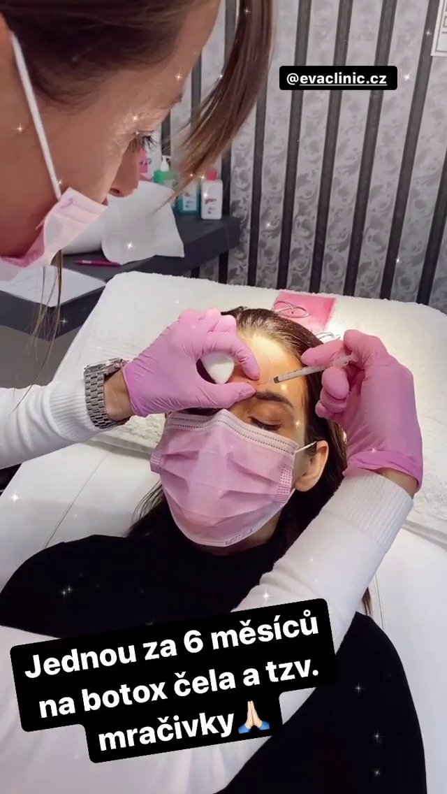 Eva Decastelo už 15 let chodí na botox