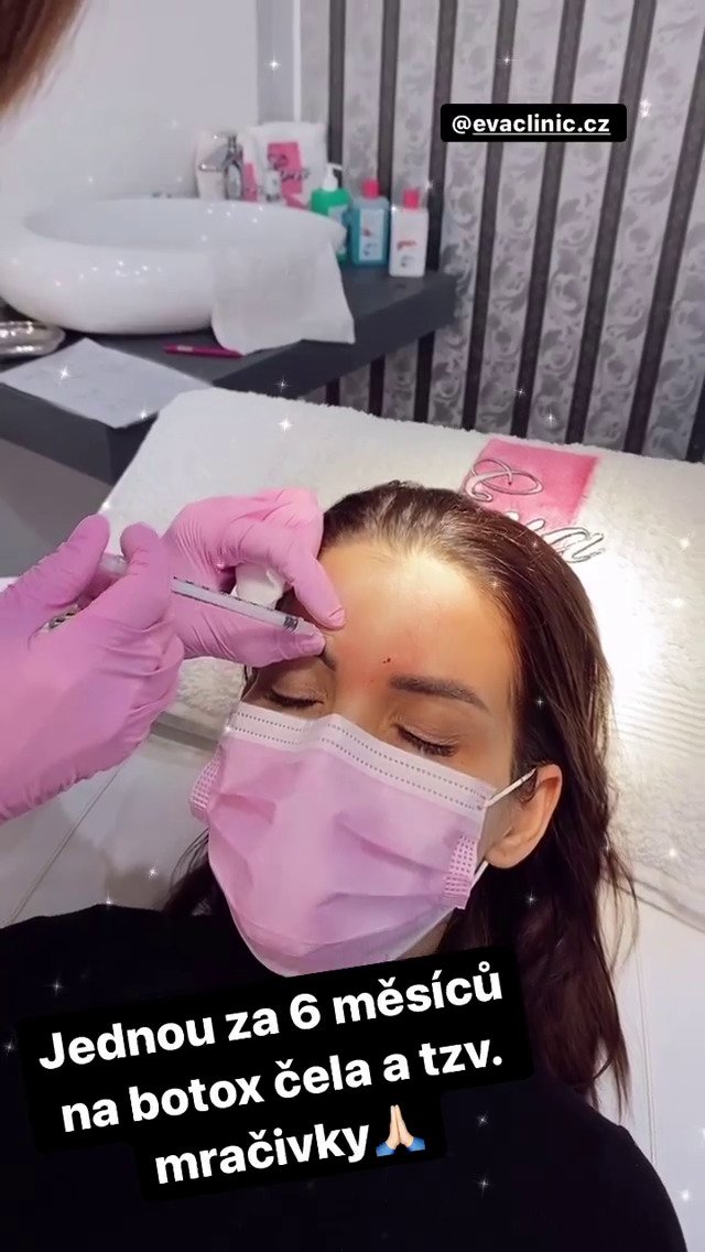 Eva Decastelo už 15 let chodí na botox