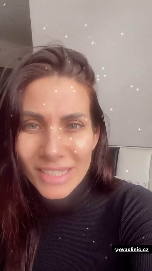 Eva Decastelo už 15 let chodí na botox.