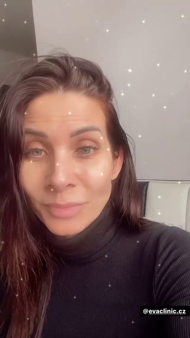 Eva Decastelo už 15 let chodí na botox