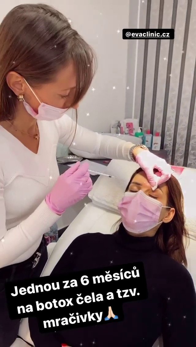 Eva Decastelo už 15 let chodí na botox