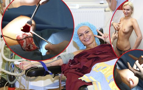 Eva Feureislová doufá, že si s implantáty vydělá více peněz na dluhy.