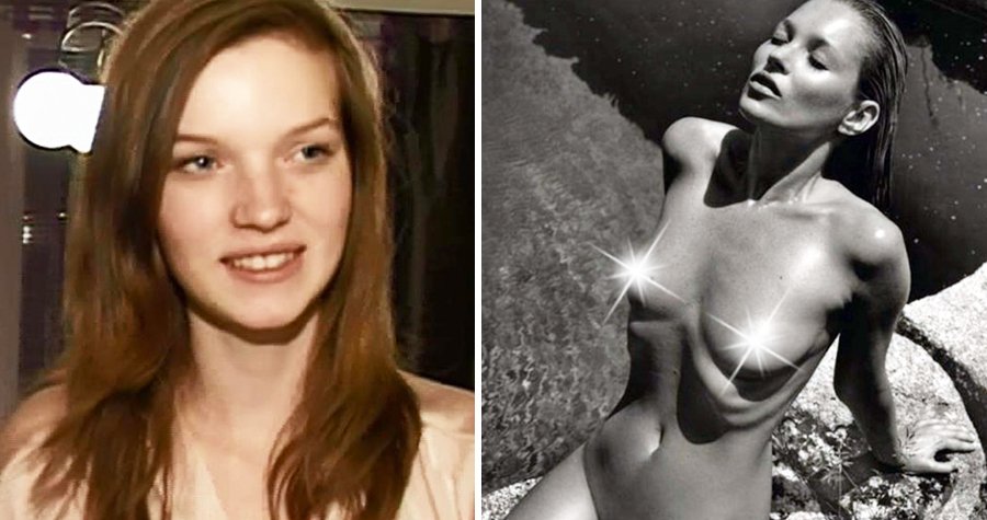 Klímková je velmi podobná Kate Moss, kterou anorexie dlouhodobě trápila, což dokazují i vystouplá žebra.