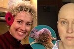 Eva onemocněla rakovinou vaječníků