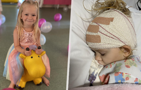 Karlova dcera (4) měla v hlavě nádor velký jako pomeranč. Lže a vy jste paranoidní, odbyli lékaři rodiče!