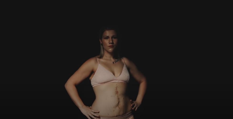 Klára vystoupila v klipu Ewy Farne k písni Tělo, aby dodala odvahu jiným.
