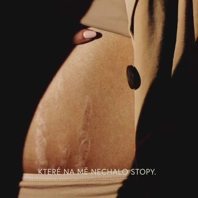 Ewa Farna v klipu Tělo ukázala následky těhotenství - strie na břiše.