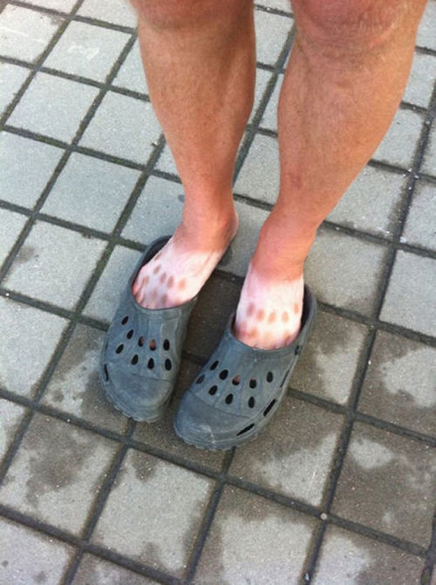 Nenoste tyhle hrozné boty na sluníčku!