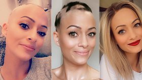 Faith O’Kellyová trpí alopecií. Vlasy jí vypadaly kvůli nitroděložnímu tělísku.