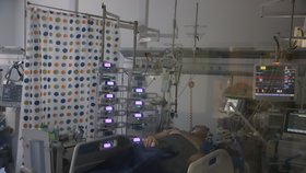 V Anesteziologicko-resuscitační klinice Fakultní nemocnice u svaté Anny v Brně evidují čím dál tím mladší pacienty s těžkým průběhem nemoci covid-19. U pacienta je nutná páska!