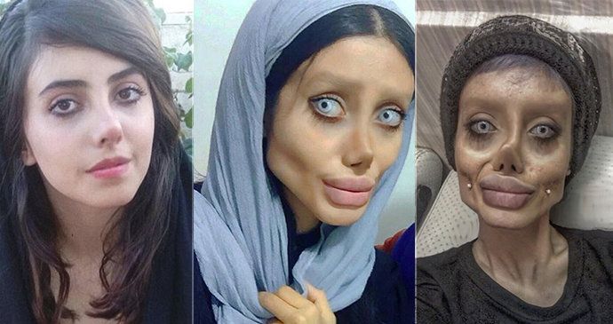 Íránka Fatemeh Khishvandová (22) alias Sahar Tabarová je prý nakažena koronavirem.