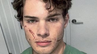 Kladivem po bradě. Šílené praktiky mladých influencerů, kteří jdou po vzhledu a nenávidí ženy Kladivem po bradě. Šílené praktiky mladých influencerů, kteří jdou po vzhledu a nenávidí ženy