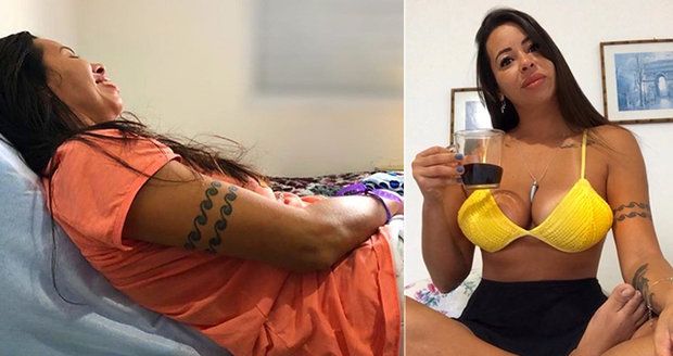 Fitness blogerku (40) postihla mrtvice: Zůstala ochrnutá na polovinu těla!