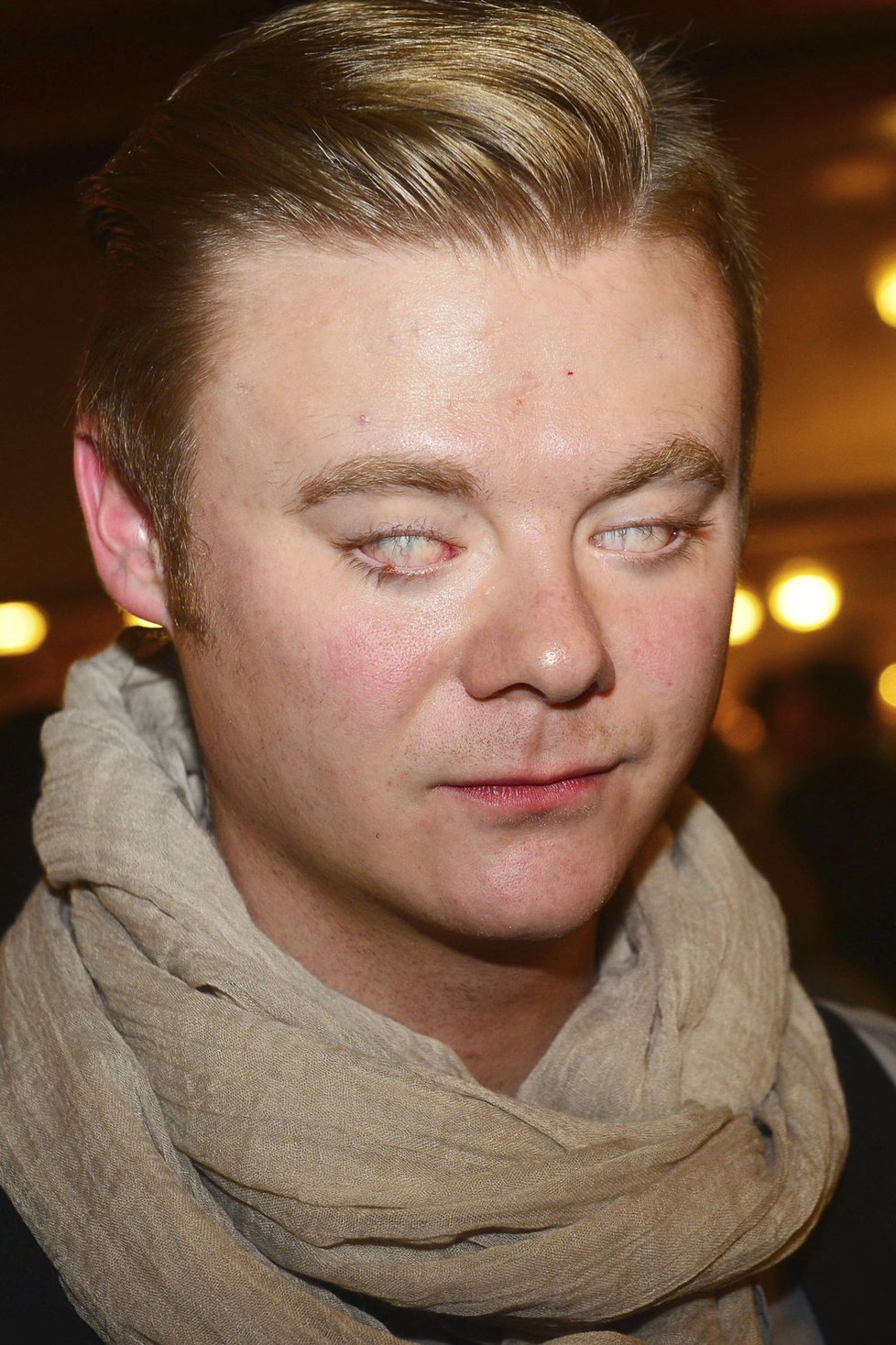 Filip Kaňkovský trpí oční vadou – kožní řasou.