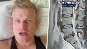 Turek skončil v nemocnici: První slova z lůžka! Blesku popsal vyšetření i hrozbu operace