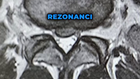 Turek vzkázal z nemocnice: Mám vyhřezlou ploténku a to poměrně drsně