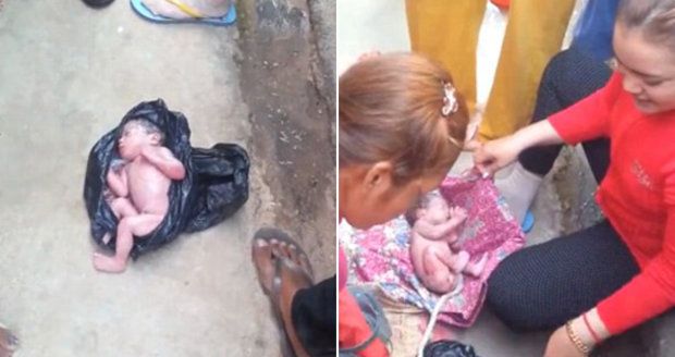 Novorozence našli na Filipínách v igelitovém pytli: Měl ještě pupečník!