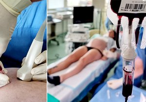 Transfuzi krve ještě nenarozenému miminku zvládají lékaři z FN Ostrava rekordně rychle. Ještě nenarozená Adélka ji dostala přes bříško mámy Nikoly do 19 minut.