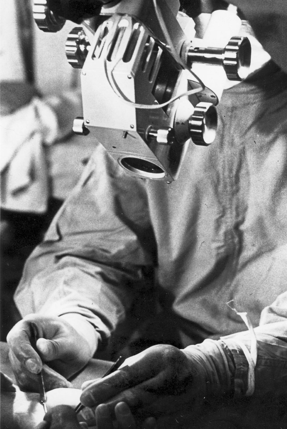 Mikrochirurgické operaci bývají velmi náročné a dlouhé.