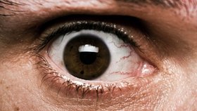 Onemocnění koronavirem může provázet řada zrakových obtíží