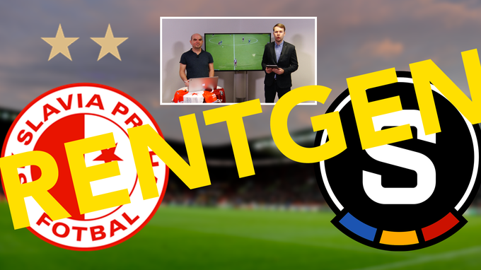 RENTGEN před derby: Sparta hoří napravo, Slavia hraje na riziko RENTGEN před derby: Sparta hoří napravo, Slavia hraje na riziko