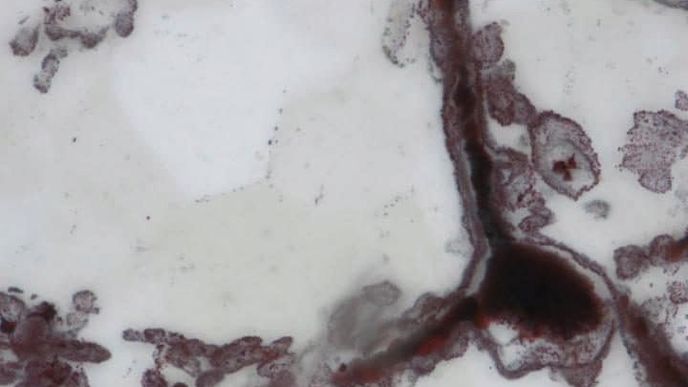 Mikroskopický snímek nejstarší fosílie bakterie