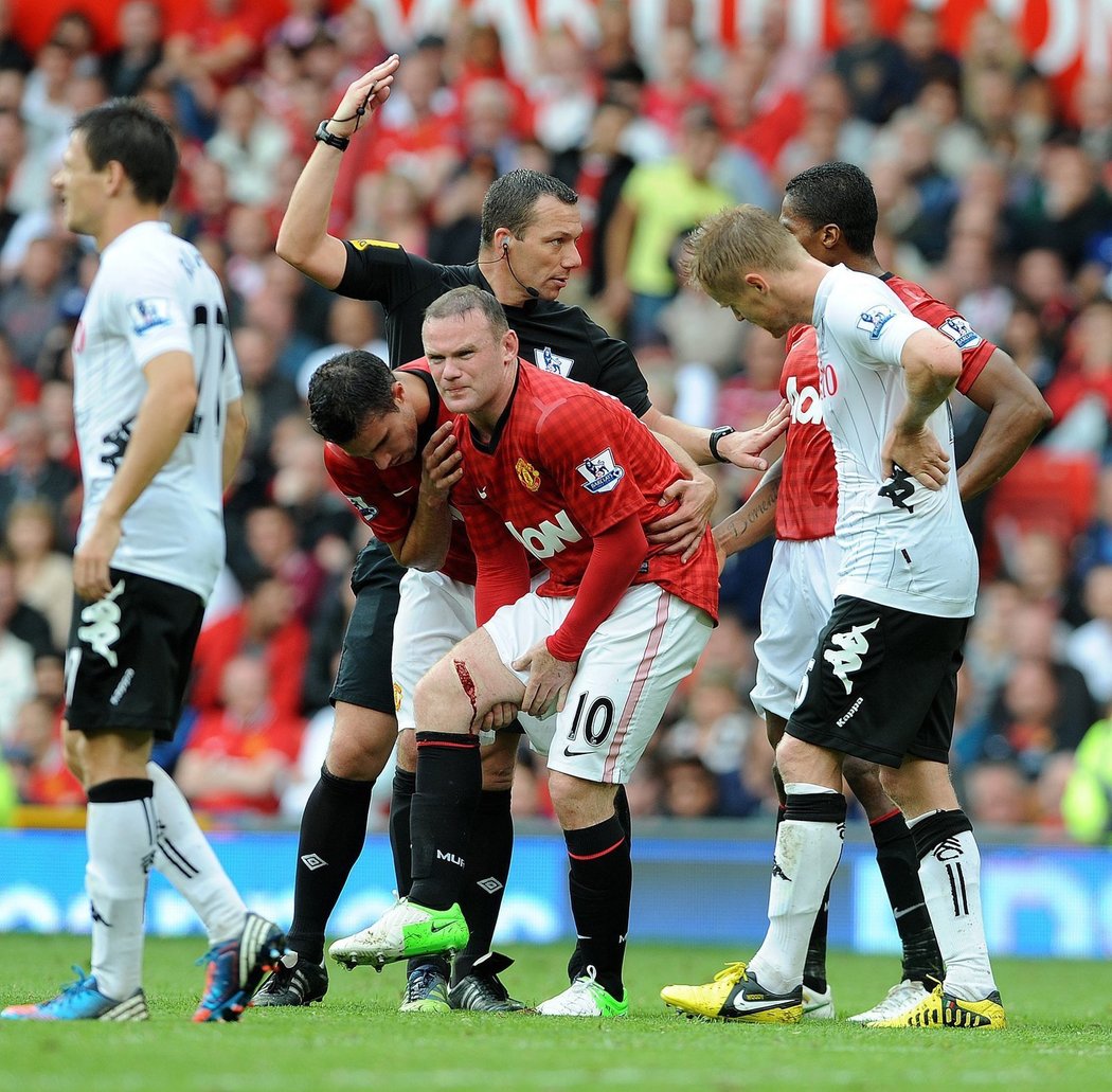 Je zle, krvácející rána na noze útočníka Rooneyho vyřadila hráče Manchesteru United ze hry