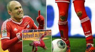 Bolavá oslava! Robben vystřelil Bayernu výhru, ale zničil si kolena