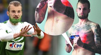 Problémy fotbalisty Beneše v Maďarsku: Vadí, že před lety přišel o ledvinu!