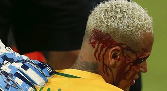 Neymar dal jubilení gól a skončil v krvi, Argentina bez Messiho tápe