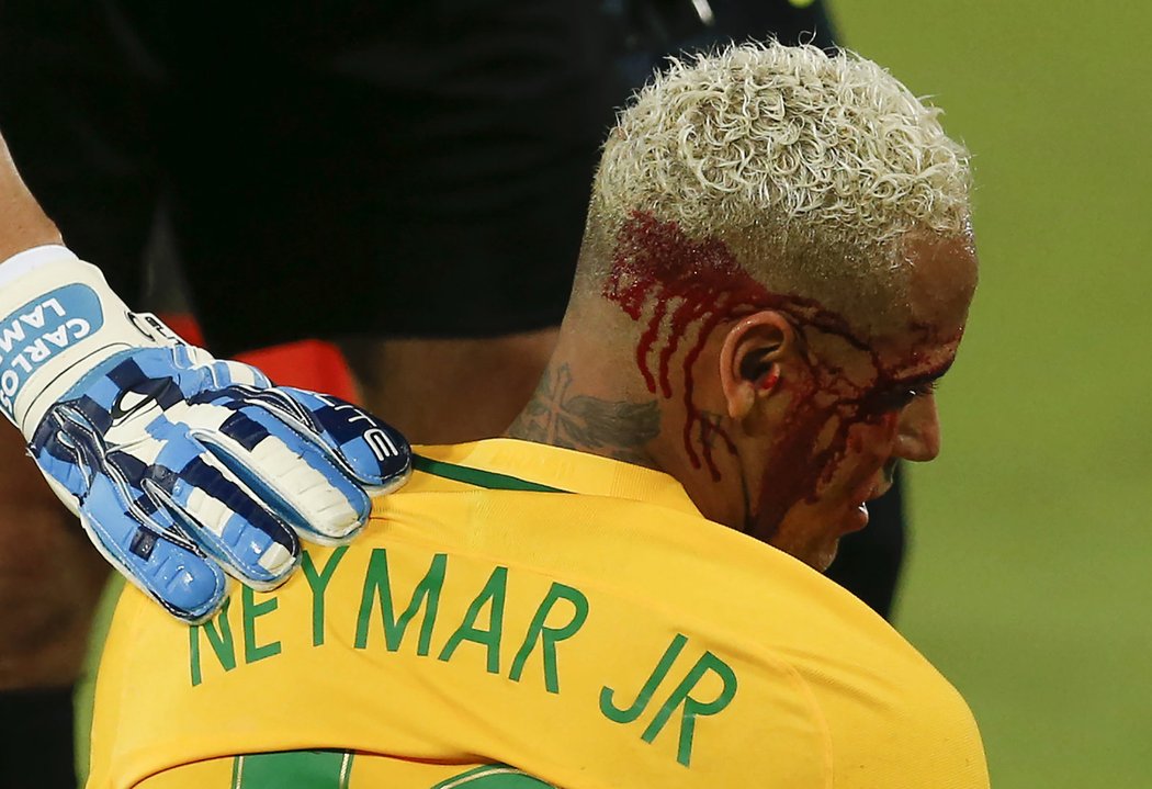 Kvůli této krvavé ráně Neymar nedohrál