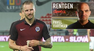 RENTGEN: Co ukázal duel se Steauou? Sparta hraje roztaženě a pomalu