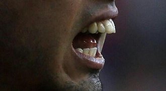 Žádné božské zuby... Suárez musí po úletu na MS úplně skončit