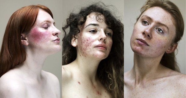 Fotografka ukázala skutečné tváře žen. Fotky na Instagramu jsou lež, říká