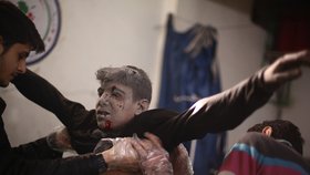 Fotograf Abd Doumany pokračuje ve své reportáži z válkou zmítané Sýrie. Na fotografii je chlapec, který byl zraněn při náletu vládních sil. Bašta rebelů Douma byla v obležení syrských jednotek více než rok. Její obyvatelé čelili nedostatku potravin, pitné vody i zdravotnického materiálu.