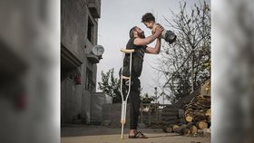 Jednonohý táta se synem bez končetin rozplakali svět. Dojemné foto zachycuje hrůzu války v Sýrii