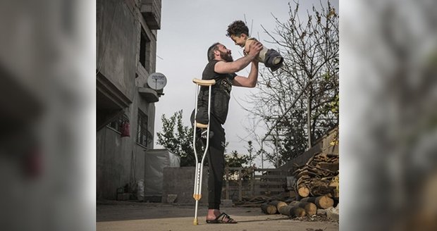 Jednonohý táta se synem bez končetin rozplakali svět. Dojemné foto zachycuje hrůzu války v Sýrii