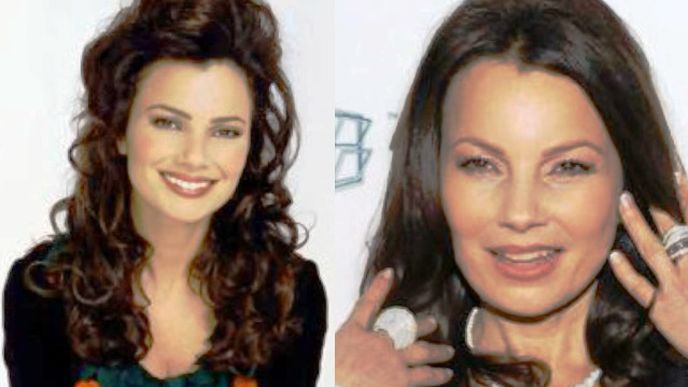 Fran Drescher.