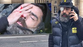 Postřelený vůdce hnutí tzv. žlutých vest Jérôme Rodrigues promluvil o svém zranění. Vyzval k protestům bez násilí.