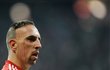 Franck Ribery - Masivní čelo, jazyk neustále venku a jeden z nejhorších účesů, co kdy svět viděl. Zjizvená tvář dělá z fotbalisty Bayernu piráta.