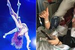 Sexy akrobatka Frankie Fatale utrpěla při pádu zlomeninu klíční kosti.
